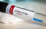 Как распознать недостоверный тест на коронавирус: советы доктора Комаровского — 10 августа 2021 — Sport24