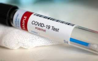 Как распознать недостоверный тест на коронавирус: советы доктора Комаровского — 10 августа 2021 — Sport24